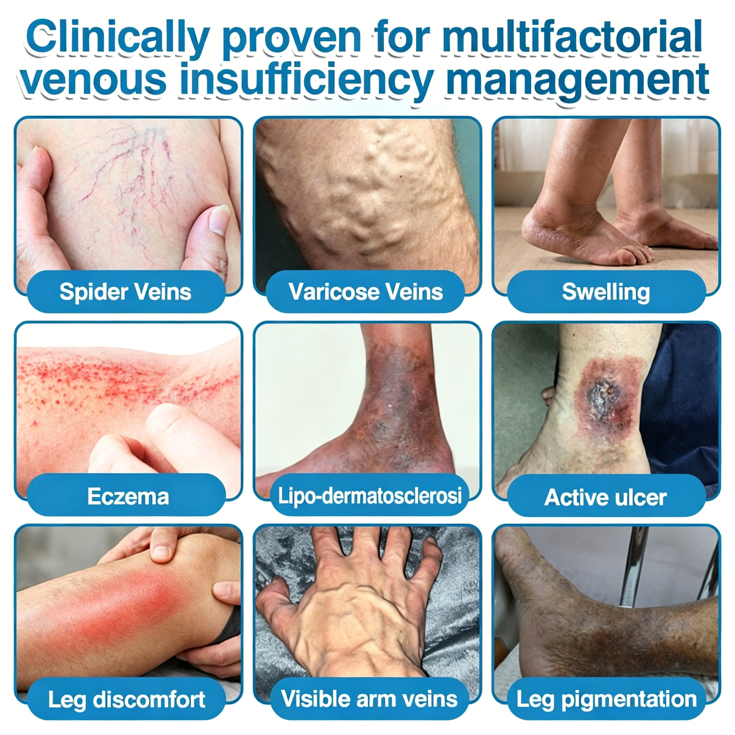 🥇👨‍⚕️✨VeinRepair Microneedle Patch Roll⚡Instant Relief, Long-Term Results